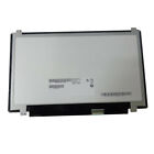 B116xtn01.0-tb Au Optronics New Laptop Led Screen Brackets 706954969256