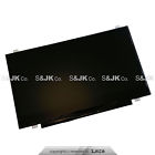 Hb140wx1-400 Cn-0m2jm1 Dell New Genuine Inspiron